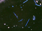 クロシドライトの顕微鏡写真